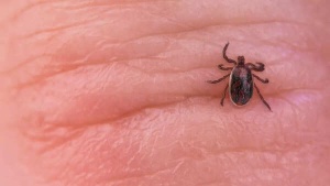 Fitness Influencer's Paralysis: Tick Bite Exposes Hidden Danger of Outdoor Activities