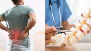 Đau lưng thông thường hay thoát vị đĩa đệm: Phân biệt thế nào để tránh biến chứng?