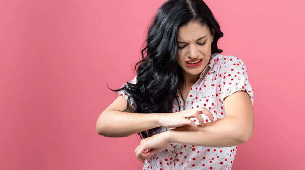An inflamed mole, a possible warning sign for cancer