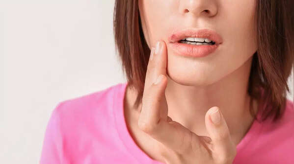 A persistent sore on the skin, a possible cancer sign