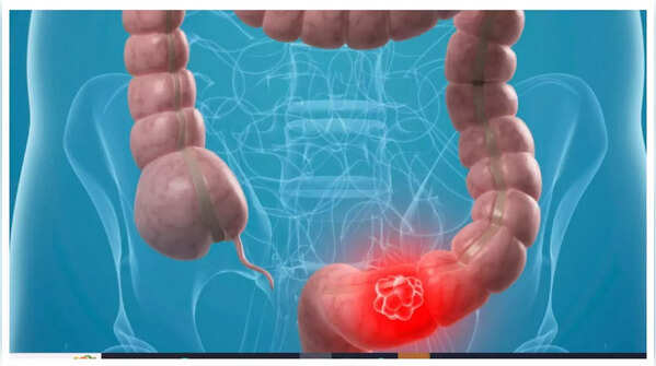 Image representing abdominal discomfort and pain.